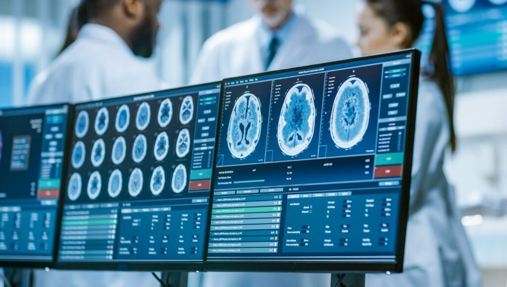 A Promising Step in Parkinson’s Research: Stem-Cell Therapy Shows Results