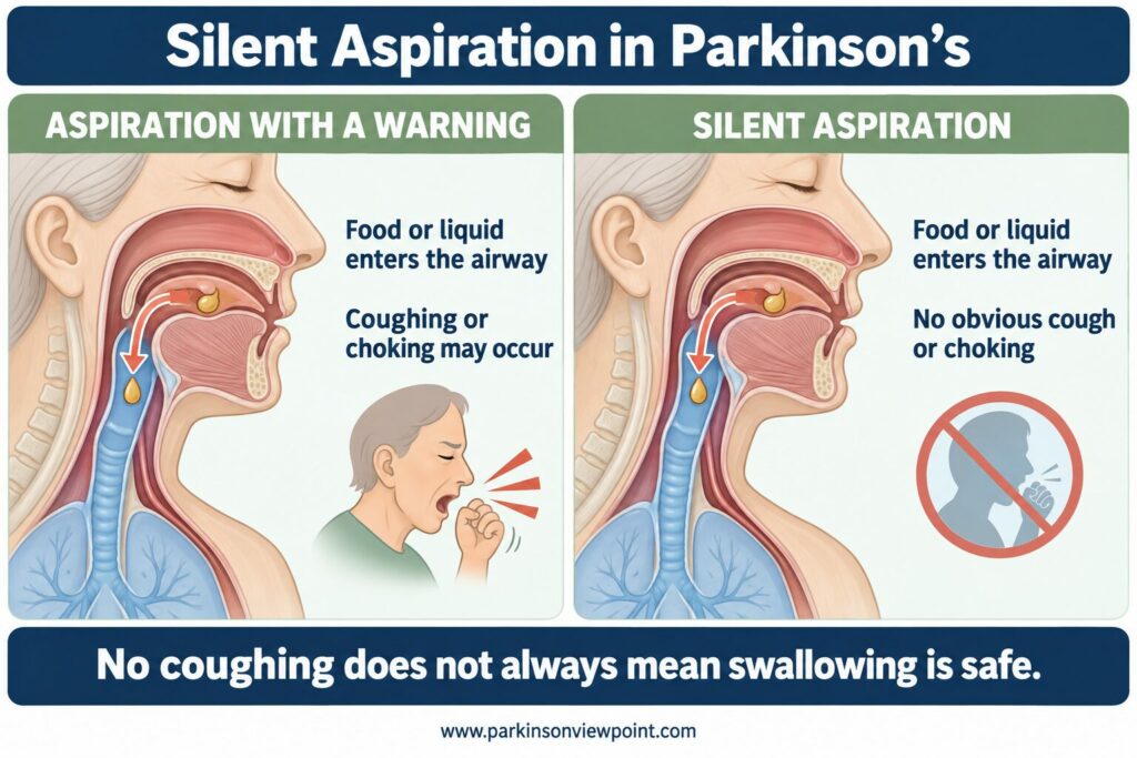 Illustration comparing aspiration that causes coughing with silent aspiration in Parkinson’s, where food or liquid enters the airway without obvious coughing or choking.